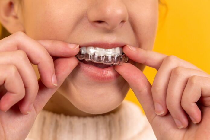 A beautiful girl puts a dental retainer on her teeth, she stands on a yellow background. Orthodontist. Dental tray. Retainer. Advertising. Place for an inscription.