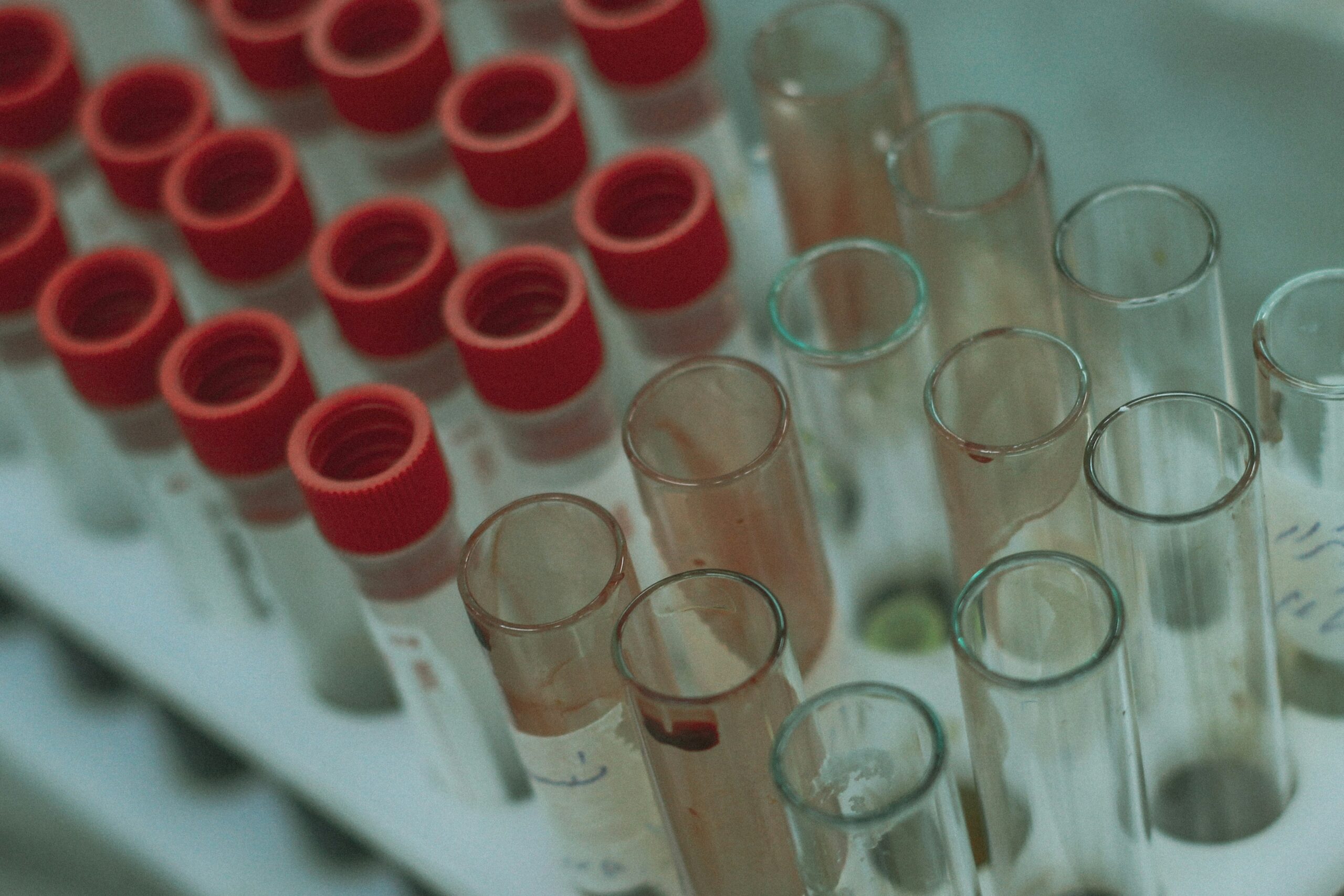 HIV και AIDS: Σιγά-σιγά, η κατάσταση βελτιώνεται